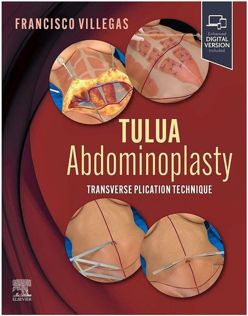 TULUA Abdominoplasty. Transverse Plication Technique (E-BOOK) - CLNZ Books