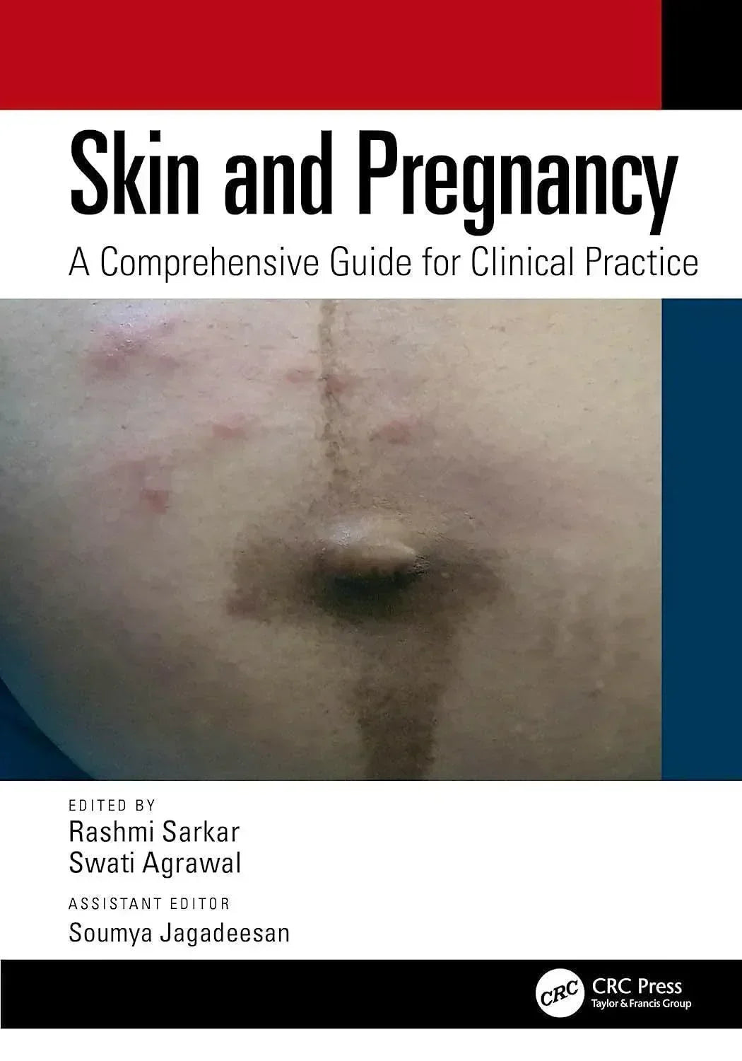 Skin and Pregnancy. A Comprehensive Guide for Clinical Practice - CLNZ Books