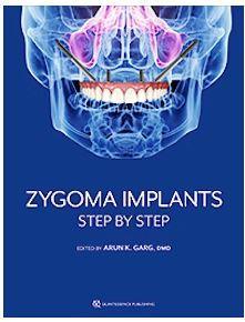 Zygoma Implants. Step by Step - CLNZ Books