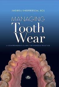 Managing Tooth Wear. A Comprehensive Guide to General Practice - CLNZ Books