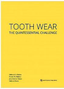 Tooth Wear. The Quintessential Challenge - CLNZ Books