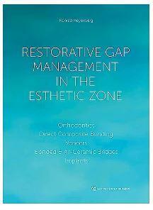 Restorative Gap Management in the Esthetic Zone - CLNZ Books