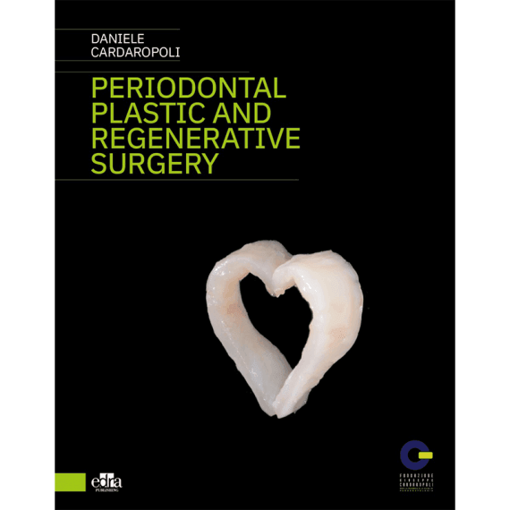 Periodontal Plastic and Regenerative Surgery - CLNZ Books