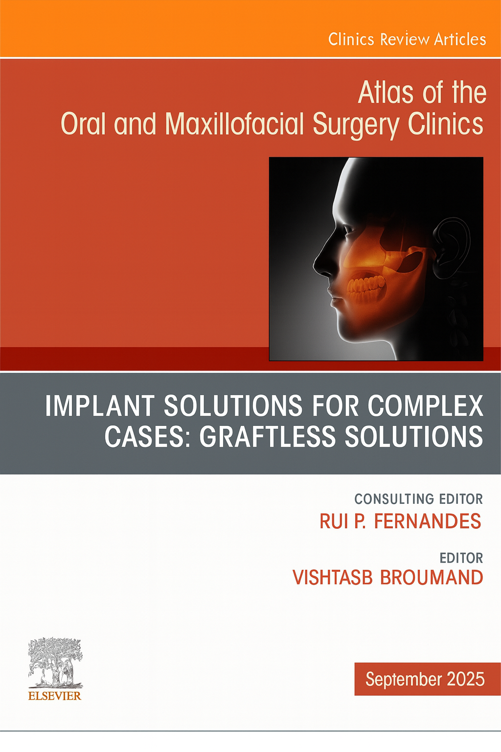 Implant Solutions for Complex Cases: Graftless Solutions, An Issue of Atlas of the Oral & Maxillofacial Surgery Clinics