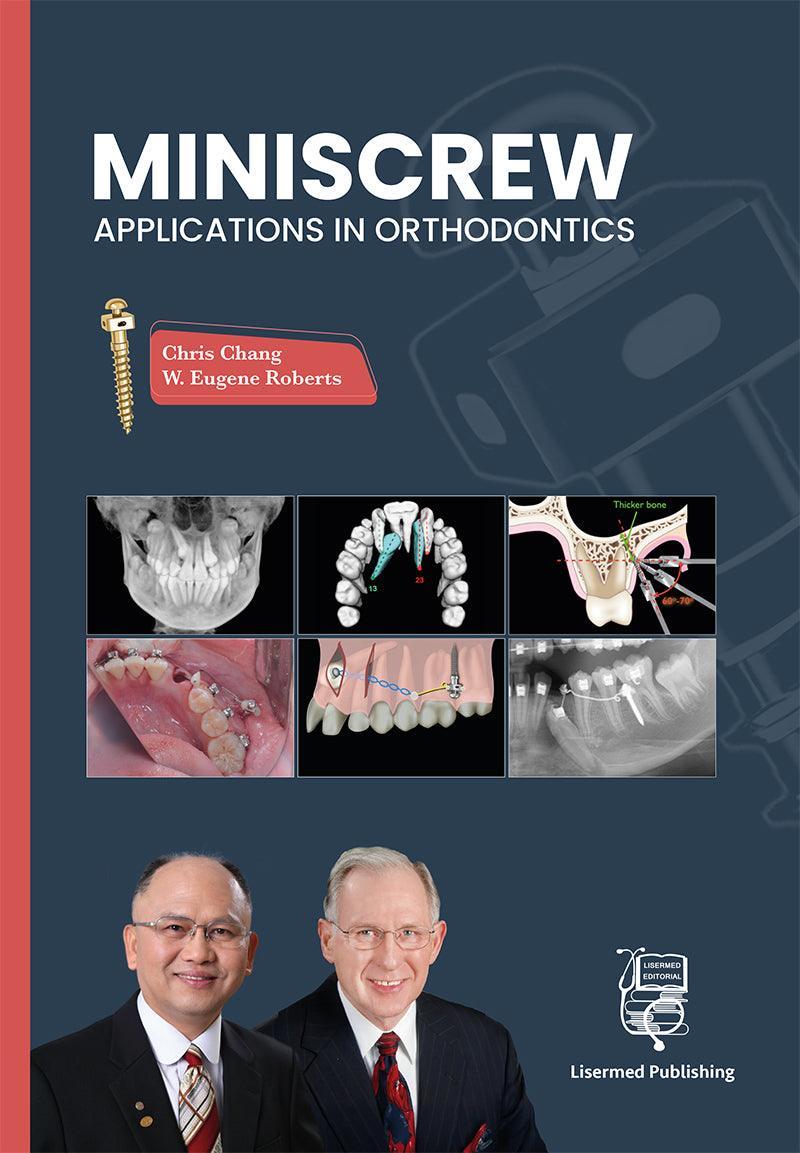 MINISCREW Applications in orthodontics - CLNZ Books