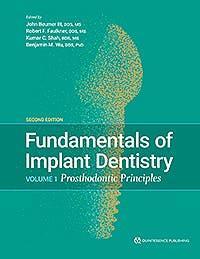 Fundamentals of Implant Dentistry, Vol. 1: Prosthodontic Principles. 2° Edition - CLNZ Books