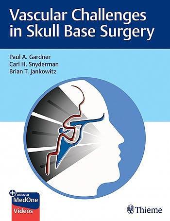 Vascular Challenges in Skull Base Surgery - CLNZ Books