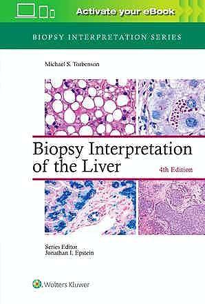 Biopsy Interpretation of the Liver. 4° Edition - CLNZ Books