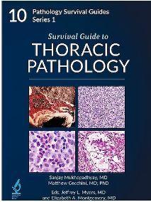 Survival Guide to Thoracic Pathology (Pathology Survival Guides Series 1, Vol. 10) - CLNZ Books
