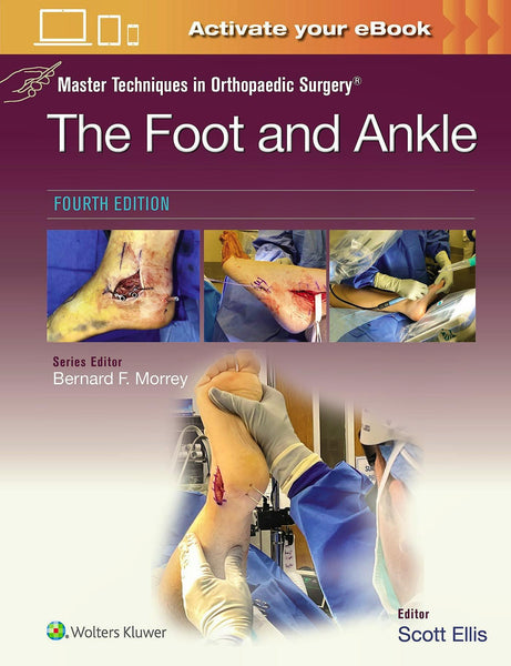 Master Techniques in Orthopaedic Surgery: The Foot and Ankle E-Book – Essential Guide for Surgeons