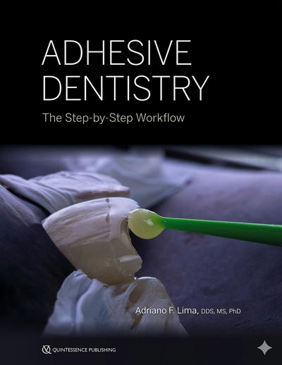 Adhesive Dentistry. The Step-by-Step Workflow