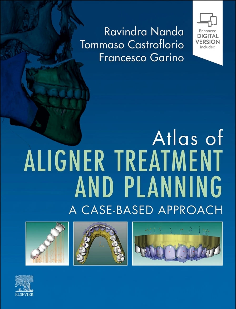 Book cover of 'Atlas of Aligner Treatment and Planning' with images of dental aligners on a blue background.