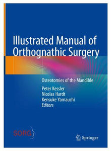 Illustrated Manual of Orthognathic Surgery. Osteotomies of the Mandible