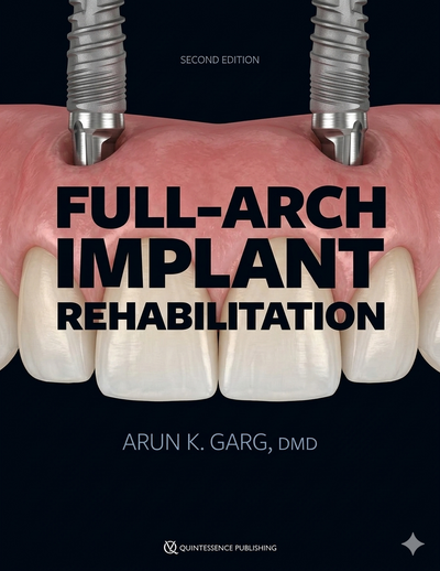 Full-Arch Implant Rehabilitation