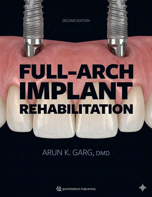 Full-Arch Implant Rehabilitation, 2nd Edition — Quintessence Publishing