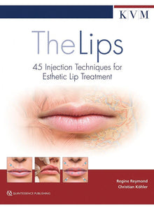 The Lips. 45 Injection Techniques for Esthetic Lip Treatment