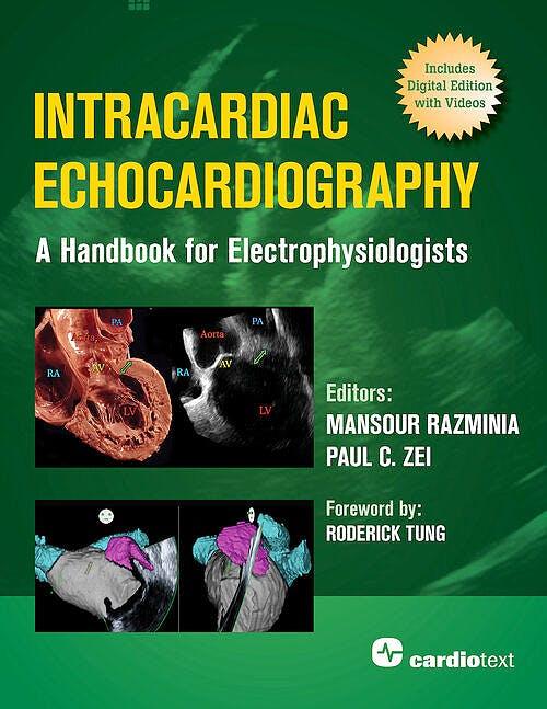 Intracardiac Echocardiography. A Handbook For Electrophysiologists