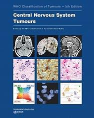 WHO Classification of Tumours. Central Nervous System. Vol. 6. 5° Edition