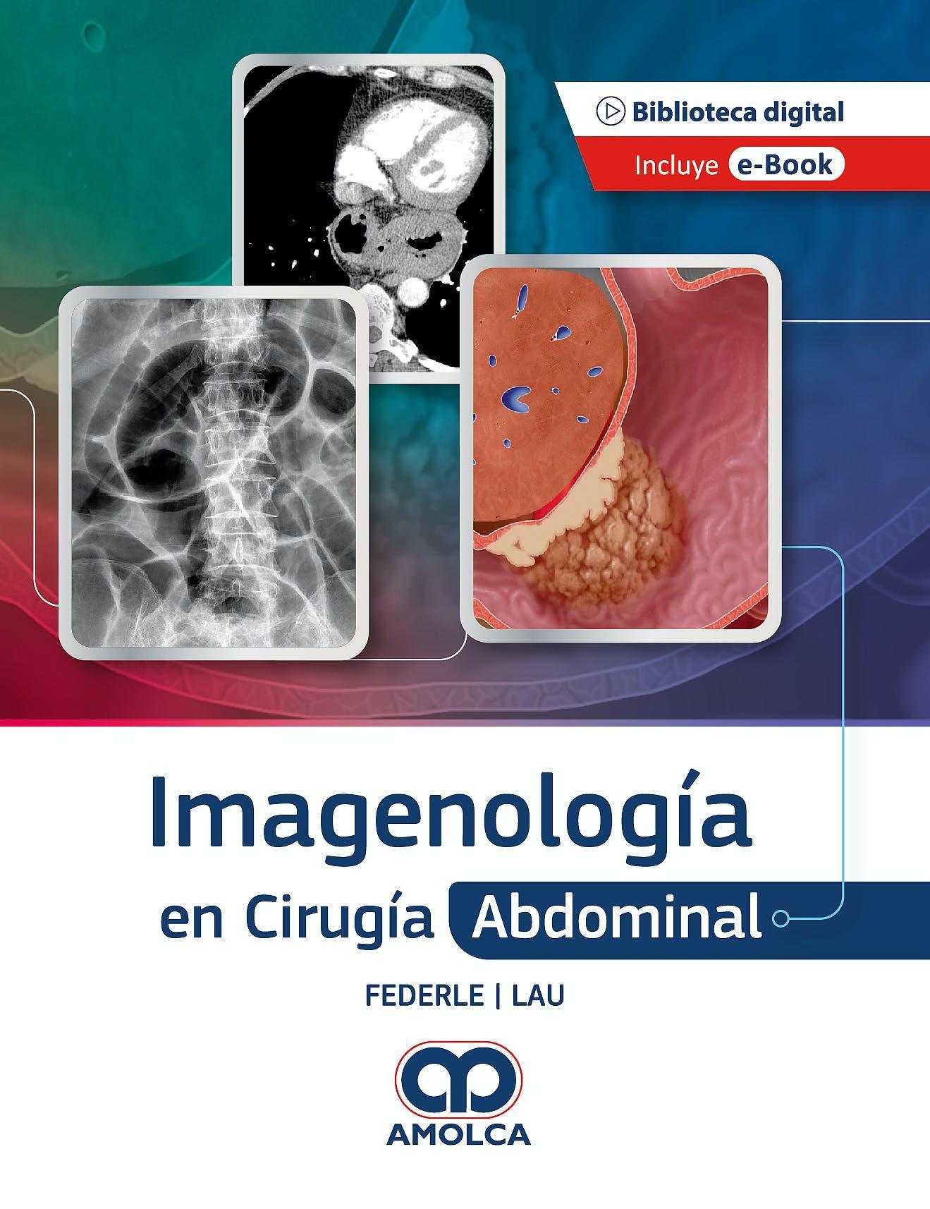 Imagenología en Cirugía Abdominal - CLNZ Books 