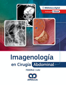 Imagenología en Cirugía Abdominal