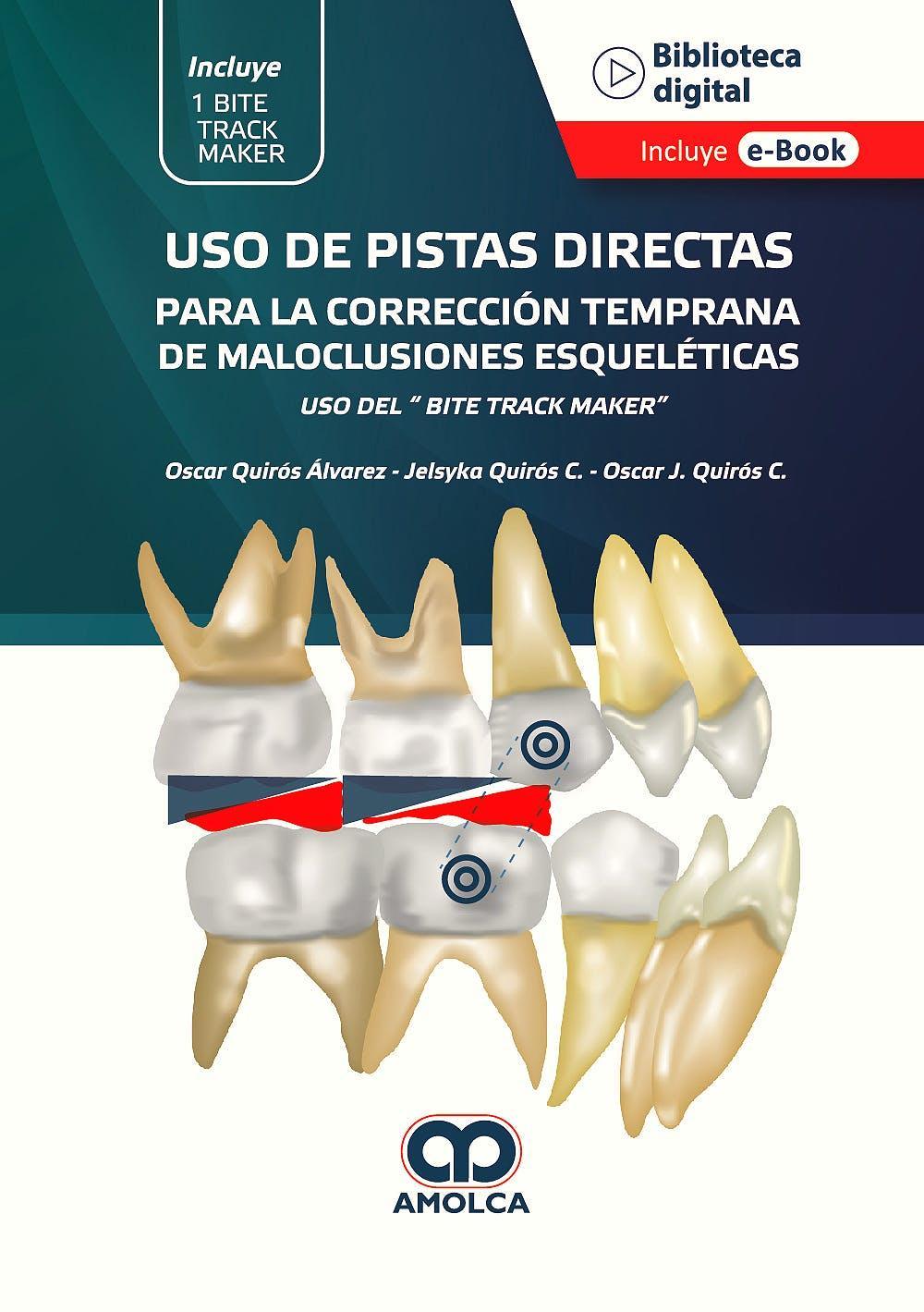 Uso de Pistas Directas para la Corrección Temprana de Maloclusiones Esqueléticas. Uso del "Bite Track Maker" - CLNZ Books 