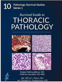 Survival Guide to Thoracic Pathology (Pathology Survival Guides Series 1, Vol. 10)